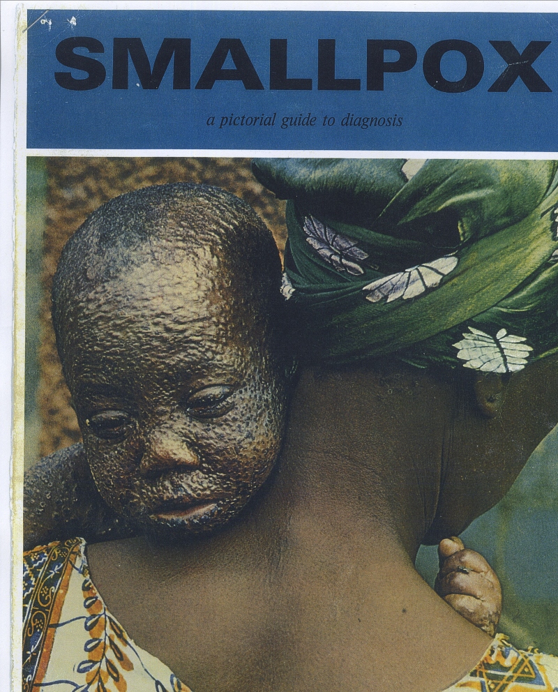Photo of mother with severely smallpox-scarred baby, World Health Organization pictorial guide to smallpox